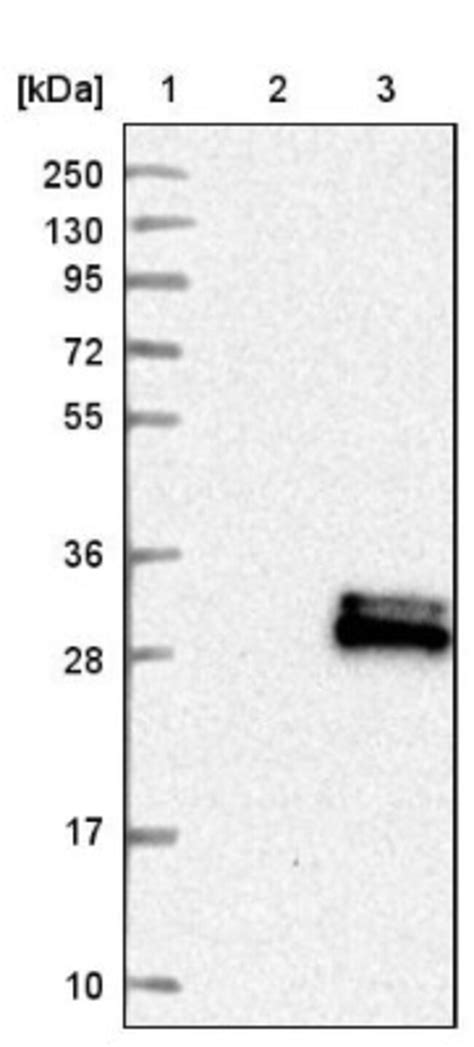 Pp Glycodelin Antibody Novus Biologicals Ml Unlabeled Fisher