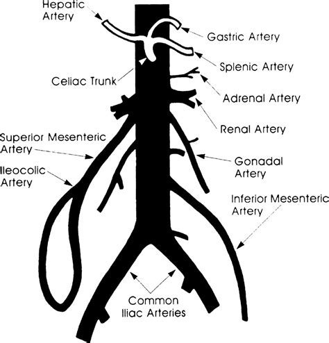 Abdominal Vascular Sonography Lange Review Ultrasonography