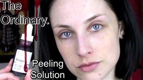 The Ordinary Peeling Solution Before And After On Dry Skin W Next Day Check In Youtube