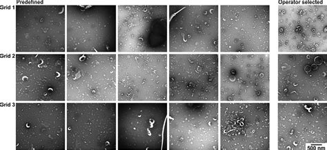 TEM images obtained with protocol A. TEM images obtained after operator ...