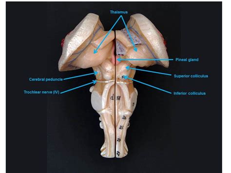 Brain Model Labeled Cranial Nerves