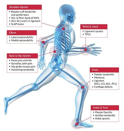 Platelet Rich Plasma Orange County Orthopedic And Podiatry Group