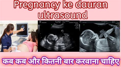 Pregnancy Ke Dauran Kab Kab Aur Kitni Bar Ultrasound Karna Chahie