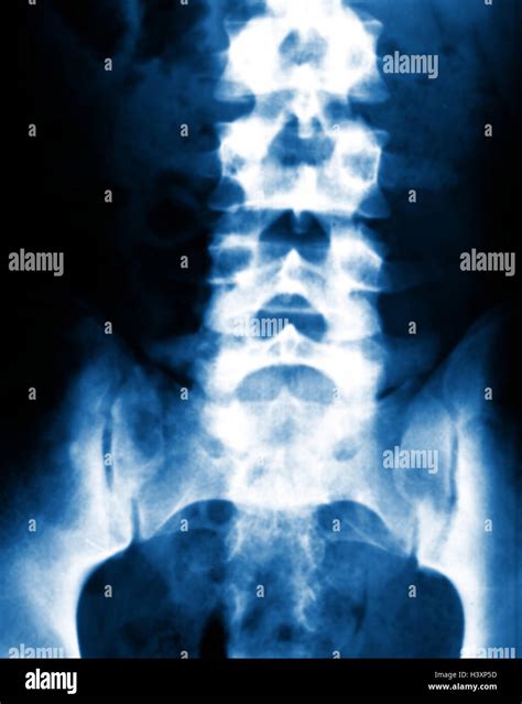 X Ray Examination Roentgenogram Hi Res Stock Photography And Images Alamy