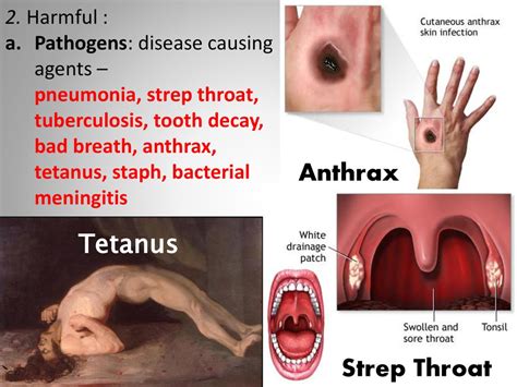 BACTERIA. - ppt download