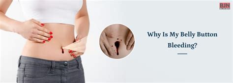 Why Does My Belly Button Bleed? – YLEAV