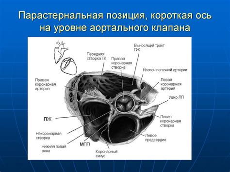 Двумерная эхокардиография - презентация онлайн