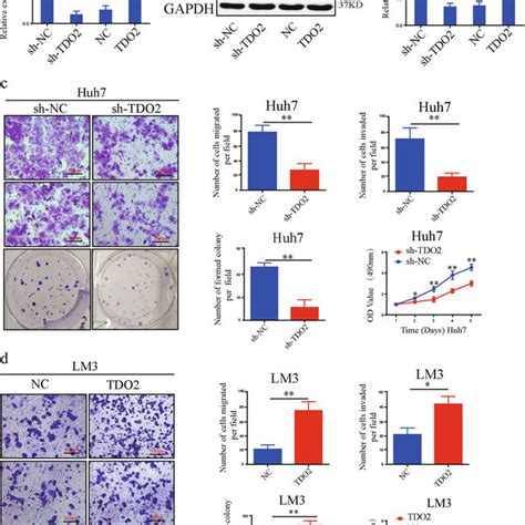 Tdo Is Upregulated In Hcc Tissues And Is Correlated With Progression