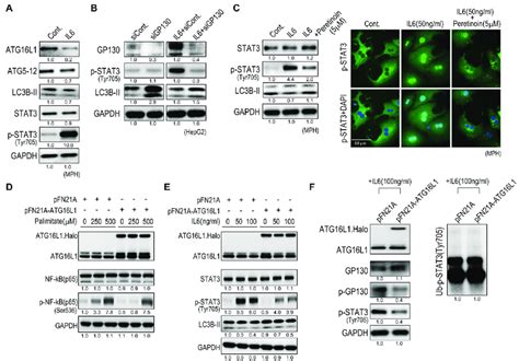 Peretinoin Inhibits Il Signaling By Up Regulating Atg L A Il