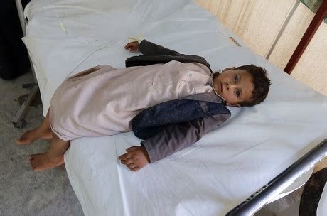 250 Cholera patient Stock Pictures, Editorial Images and Stock Photos ...