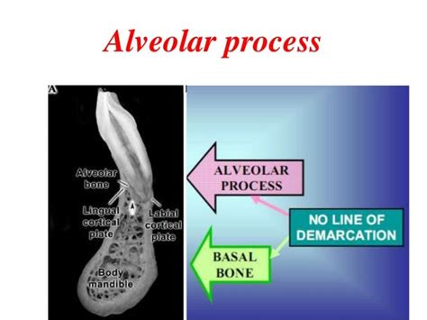 Alveolar