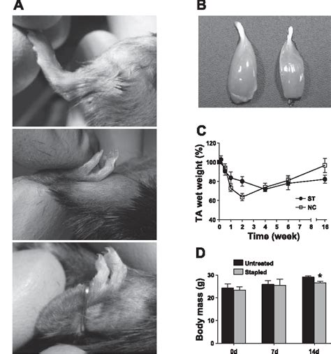 Figure From Highlighted Topic Regulation Of Protein Metabolism In