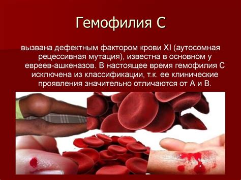 Гемофилия - презентация онлайн