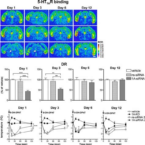 Increased Extracellular Serotonin 5 Ht Concentration In 5 Ht 1a