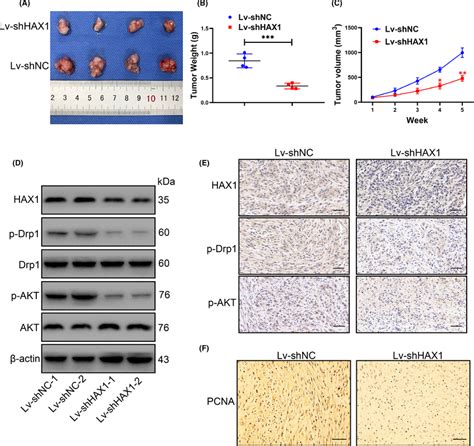 Hax Knockdown Reduced The Growth Of Glioma In Vivo Glioma Cells