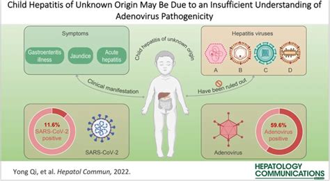 Nueva Interpretaci N De Posibles Causas De La Hepatitis Aguda Infantil