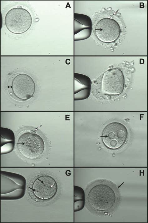 Oocytes With Normal And Abnormal Morphology A Normal Oocyte B