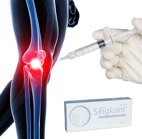 Assisting The Treatment Of Osteoarthritis Hyaluronic Acid Gel Knee