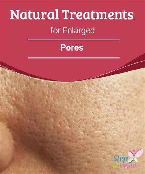 A Natural Treatment For Large Pores Remove Them Once And For All