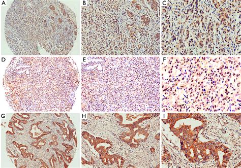 Representative Image Of Immunohistochemical Based Staining Of Er Er