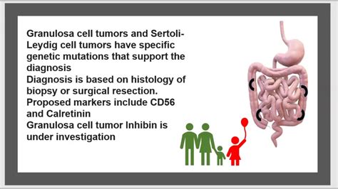 Sex Cord Stromal Ovarian Cancer Ovarian Germ Cell Tumors Ovary