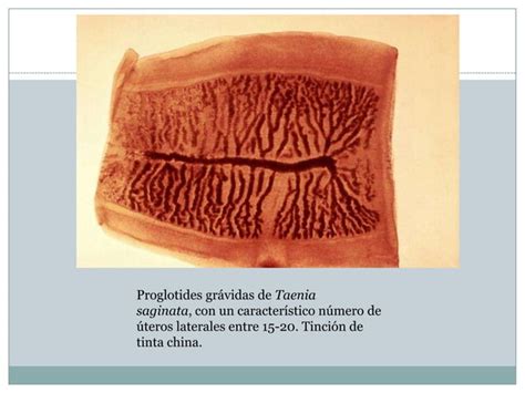 Taenia Solium PPT