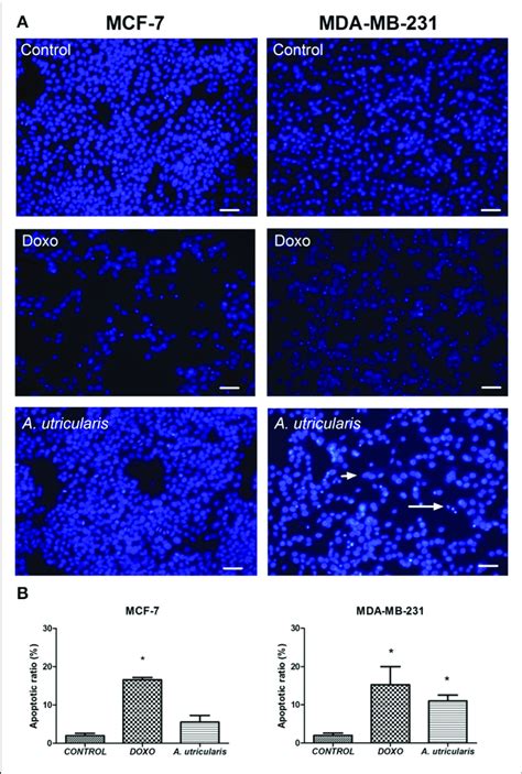 MCF 7 And MDA MB 231 Cell Apoptosis As Assessed By DAPI Staining