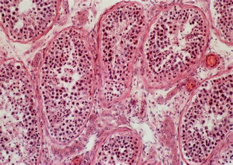 Light Micrograph Of Normal Human Testis Photograph By Astrid And Hanns