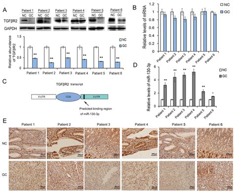 The Expression Patterns Of Tgf R And Mir In Gc Tissues A Western