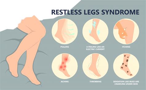 Restless Legs Syndrome How Serious Is It Sleep Research Foundation