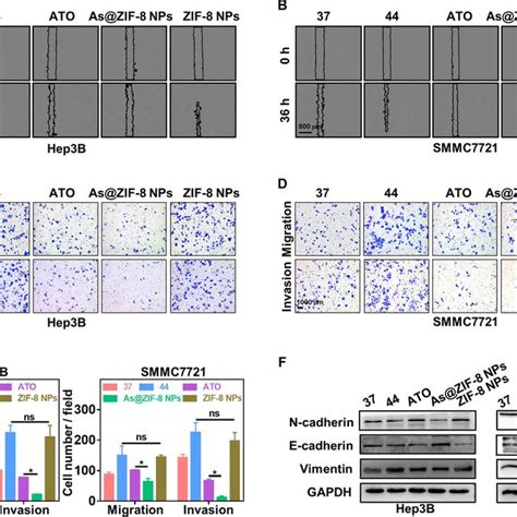 Preparation And Characterization Of ZIF 8 As ZIF 8 And As ZIF 8 PEG A