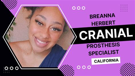 Breanna Herbert Cranial Prosthesis Specialist Bakersfield California