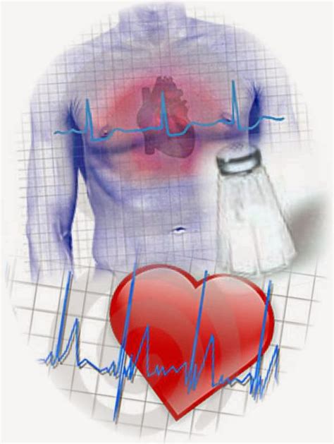 Hipertensión Arterial Factores De Riesgo