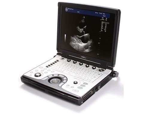 Ge Nextgen Logiq E R8 Portable Ultrasound System Save At Tiger Medical Inc