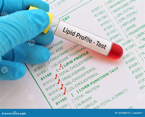 Lipid Profile Test Stock Image Image Of Laboratory