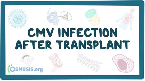 Cytomegalovirus Infection After Transplant Nord Video Causes