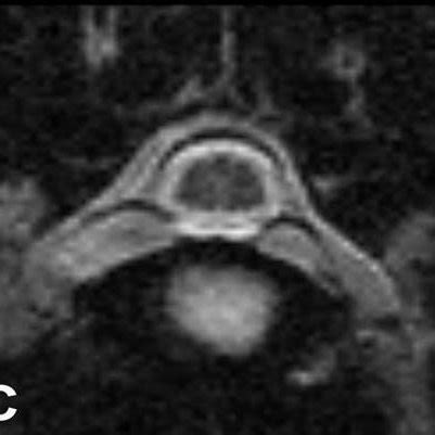 Sagittal And Transverse T Weighted Tr Milliseconds Te