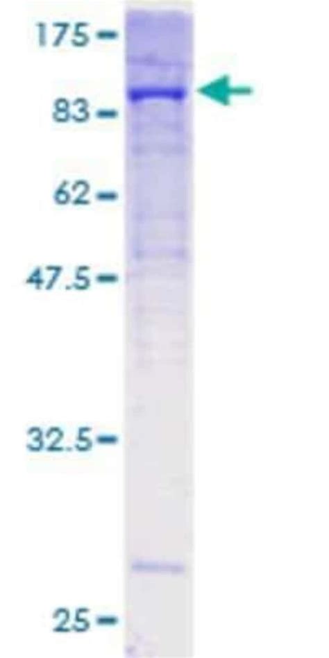 Novus Biologicals Recombinant Human Collagen V GST N Term Protein 10