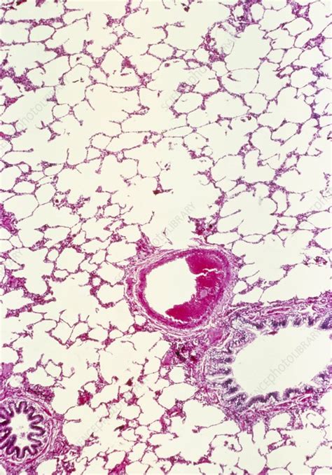 LM Of A Cross Section Through Lung Tissue Stock Image P590 0172