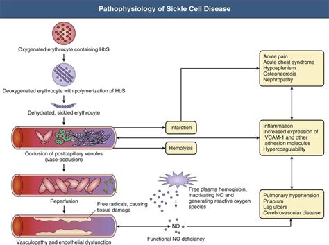 Sickle Cell Disease | Abdominal Key