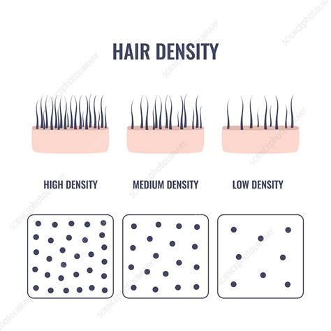 Hair Density Types Conceptual Illustration Stock Image F0342813 Science Photo Library