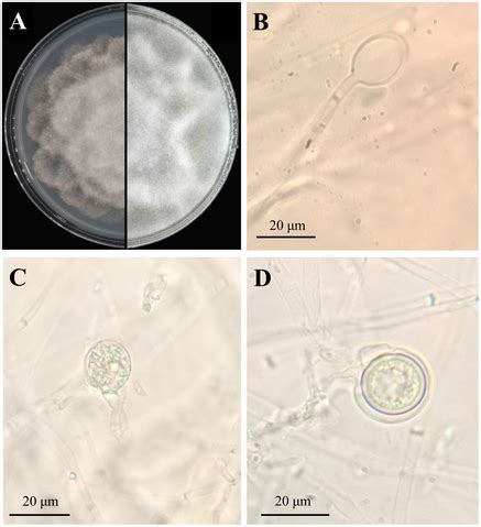 File Phytophthora Cinnamomi Under Microscope Png Wikipedia