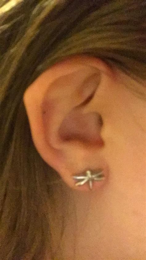 I Was Born With A Pointed Ear Making It Look Like I Could Be An Elf R Mildlyinteresting