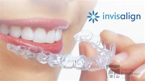 Invisalign Treatment In Turkey Dental Excellence Turkey Blog