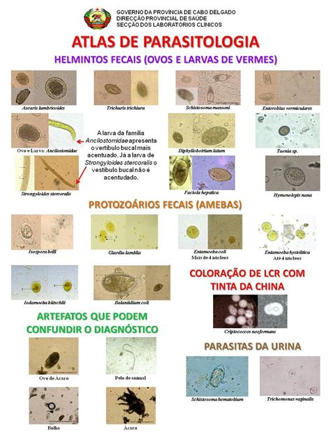 Urine Microscopy And Casts Image Atlas Key Squamous Artofit