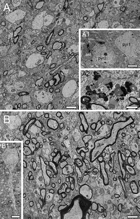 Neuronal Organization Of L6 In The Human TLN A Low Power Electron