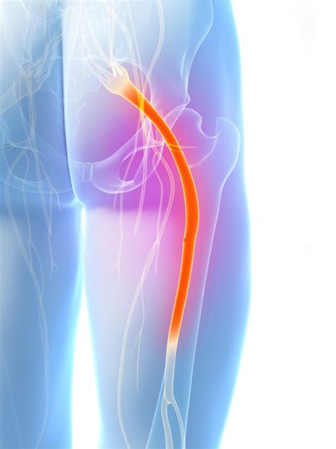 Pain In The Backside: Dealing With Sciatic Nerve Pain | Chiropractor Houston Texas | Harper ...