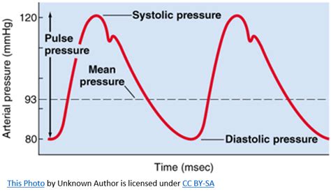 Mean Arterial Pressure Diagram