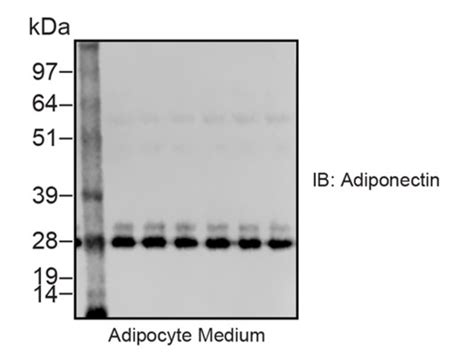 Reliable Adiponectin Antibody | Biocompare Antibody Review