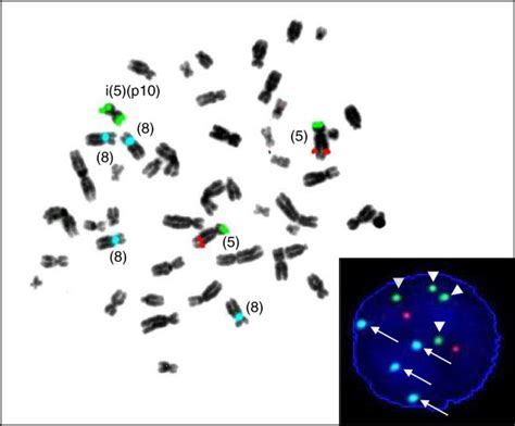 Fish Analysis Using Locus Specific Probes For Chromosome P Q And A